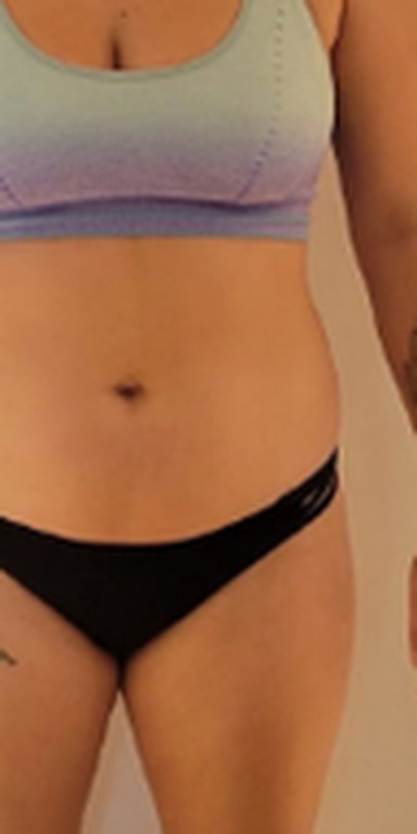 Sophie before