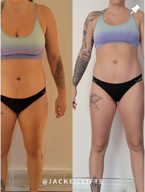 Sophie's before and after photos